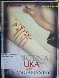 Image of MENGENAL LUKA DAN PENANGANANNYA
